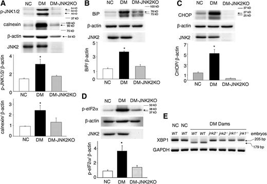 FIG. 3. Deletion of the jnk2 gene blocks maternal diabetes–induced ER stress. Levels of p-JNK1/2 and calnexin (A), BiP (B), CHOP (C), and p-eIF2α (D) in WT embryos from the nondiabetic control (NC) group and the diabetes mellitus (DM) group and jnk2−/− embryos from diabetic JNK2KO dams (DM-JNK2KO). E: XBP1 mRNA splicing in WT embryos of the NC and DM groups, jnk2−/− embryos from diabetic JNK2KO dams, and jnk1−/− embryos of diabetic jnk1+/− dams mated with jnk1+/− males. Experiments were repeated three times using samples from different dams in each group. In A–D, arrows point to the actual sizes of the targeted proteins, and adjacent protein markers are indicated. *Significant difference (P < 0.05) compared with the other two groups.
