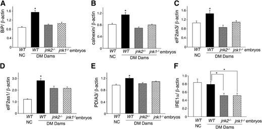 FIG. 4. Targeted deletions of either jnk1 or jnk2 gene suppress maternal diabetes–induced ER chaperone gene expression. mRNA levels of BiP (A), calnexin (B), eIF2ak3 (C), eIF2as1 (D), PDIA3 (E), and IRE1α (F) in WT embryos of the nondiabetic control (NC) group and diabetes mellitus (DM) group, jnk2−/− embryos from diabetic JNK2KO dams, and jnk1−/− embryos of diabetic jnk1+/− dams mated with jnk1+/− males. Five embryonic samples (n = 5) from five different dams of each group were used for real-time PCR. *Significant difference (P < 0.05) compared with the other two groups.