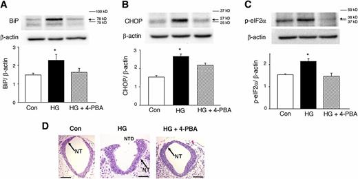 FIG. 5. 4-PBA suppresses high glucose–induced ER stress and NTD formation. Levels of BiP (A), CHOP (B), and p-eIF2α (C) in embryos cultured under 5 mmol/L glucose (control [Con]), 20 mmol/L glucose (high glucose [HG]), and 20 mmol/L glucose plus 2 mmol/L 4-PBA conditions (HG + 4-PBA). Experiments were repeated three times using samples from three independent cultures. D: Representative images of closed neural tubes from the Con group and HG plus 2 mmol/L 4-PBA group and the open neural tube (NT) structure of an NTD embryo from the HG group. Scale bars, 0.5 mm. In A–C, arrows point to the actual sizes of the targeted proteins, and adjacent protein markers are indicated. *Significant difference (P < 0.05) compared with the other two groups. (A high-quality color representation of this figure is available in the online issue.)