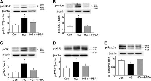 FIG. 6. 4-PBA treatment blocks high glucose–induced JNK1/2 pathway activation. Levels of p-JNK1/2 (A), p–c-Jun (B), p-Elk1 (C), p–ATF-2 (D), and p-Foxo3a (E) in embryos cultured under 5 mmol/L glucose (control [Con]), 20 mmol/L glucose (high glucose [HG]), and 20 mmol/L glucose plus 2 mmol/L 4-PBA conditions (HG + 4-PBA). Experiments were repeated three times using samples from three independent cultures. In A–E, arrows point to the actual sizes of the targeted proteins, and adjacent protein markers are indicated. *Significant difference (P < 0.05) compared with the other two groups.