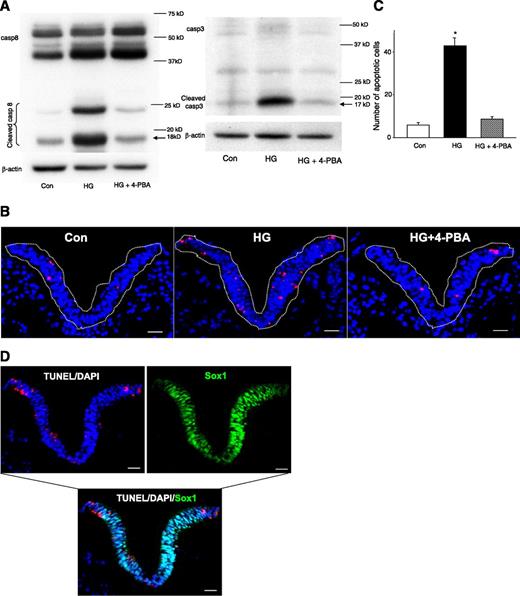 FIG. 7. 4-PBA treatment abolishes high glucose–induced caspase activation and neuroepithelial cell apoptosis. In A, cleaved caspase 3 and 8 were analyzed in embryos cultured under 5 mmol/L glucose (control [Con]), 20 mmol/L glucose (high glucose [HG]), and 20 mmol/L glucose plus 2 mmol/L 4-PBA conditions (HG + 4-PBA). Experiments were repeated three times using cultured embryos from different dams, and similar results for caspase cleavage were obtained. Representative images of the TUNEL assays are shown in B. Apoptotic cells are labeled in red, and all cells are labeled in blue. The dense blue areas, which are marked by white dash lines, are neuroepithelia of cultured embryos. Scale bars, 30 μm. C shows quantification of apoptotic cells in the whole anterior neural tube of 12-h cultured embryos. Five serial coronal sections though the anterior neural tubes of each embryo were analyzed. In each group, six embryos from three independent cultures were used. The numbers of apoptotic cells were counted in the neural tube area of each section and averaged by the five sections for each embryo. In D, apoptotic cells labeled by TUNEL (red) staining are Sox1-positive (green) neural progenitors in the neuroepithelia of the HG group. The same section was sequentially stained by TUNEL, DAPI, and Sox1. Cell nuclei were stained by DAPI in blue. Scale bars, 30 μm. *Significant difference (P < 0.01) compared with the other two groups. (A high-quality color representation of this figure is available in the online issue.)