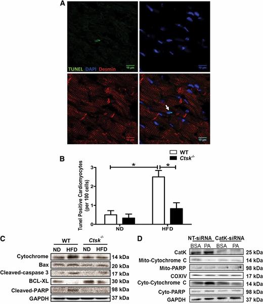 FIG. 6. A and B: Representative TUNEL staining of cardiomyocytes from heart sections of wild-type (WT) mice fed a high-fat diet (HFD). Apoptotic nuclei stained by TUNEL (green), counterstained with DAPI (blue) to mark nuclei, and cardiomyocytes (desmin, red) were imaged by confocal microscopy, arrow indicates TUNEL-positive nuclei in the cardiomyocyte (A); and quantitation of TUNEL-positive cardiomyocytes (B). ND, normal diet. *P < 0.05 between the notated groups. C: Effect of cathepsin K knockout on HFD-induced cardiac apoptosis. Representative Western blot image of proapoptotic proteins cytochrome C, BAX, cleaved caspase-3, cleaved nuclear enzyme poly (ADP-ribose) polymerase (PARP), and the antiapoptotic protein BCL-XL are shown. D: H9c2 myoblasts were transfected with nontarget siRNA (NT-siRNA) or cathepsin K siRNA in the presence of palmitic acid (0.4 mmol/L, 6 h) or vehicle BSA. Representative gel blots of total cathepsin K, mitochondrial cytochrome C, mitochondrial PARP, COXIV (loading control), and cytosolic cytochrome C, cytosolic PARP, and GAPDH (loading control). (A high-quality digital representation of this figure is available in the online issue.)