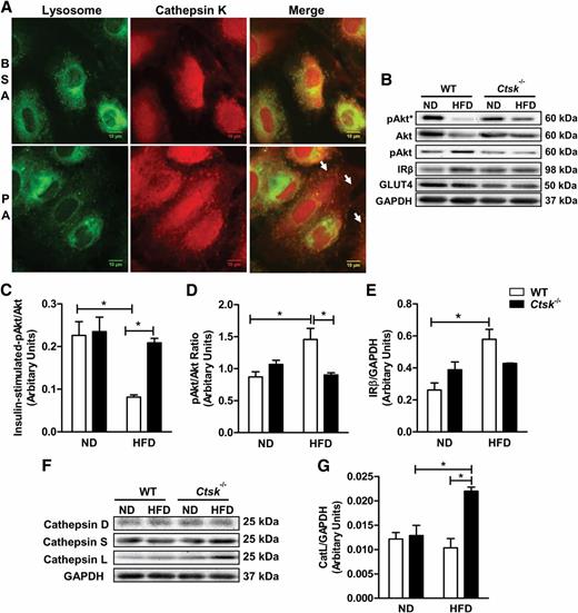 FIG. 7. A: Immunolocalization of cathepsin K in cultured cells. H9c2 myoblasts were labeled using lysosomal dye and fluorogenic substrate MR-(LR)2, which detects active cathepsin K. Upper panel (merged figure) shows colocalization of cathepsin K in lysosomes under basal conditions. On stimulation with palmitic acid, active cathepsin K was released from lysosomes to the cytoplasm (indicated by arrows). B–E. Effect of cathepsin K knockout on cardiac insulin signaling molecules in normal diet (ND)-fed and high-fat diet (HFD)-fed mice. Mice were challenged with insulin (1.5 U/100 g body weight, intraperitoneally) for 10 min before isolation of the heart tissue for Western blot. Insulin-stimulated phosphorylation of Akt (indicated by an asterisk), total Akt, basal phospho-Akt, basal levels of insulin receptor-β, and glucose transporter-4 (Glut4) were assessed by Western blotting (B) and quantitated by densitometry (C–E). F and G: Effect of cathepsin K knockout on the protein levels of other cathepsins in ND-fed and HFD-fed mice. Mean ± SEM, n = 3–4 per group. WT, wild-type. *P < 0.05 between the notated groups. (A high-quality digital representation of this figure is available in the online issue.)
