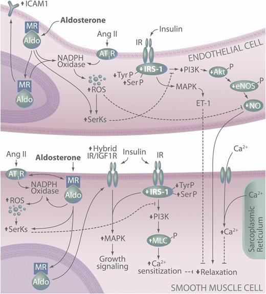 FIG. 1. MR-dependent effects on endothelial and SMC function and insulin signaling. In vascular cells, MR activation leads to attenuated insulin signaling and ultimately reduced insulin-induced vasodilation. This involves activation of redox-sensitive and -insensitive serine kinases (SerKs), degradation of IRS-1, reduced IRS-1 signaling via PI3K, reduced production of NO, and increased smooth muscle Ca2+ levels and sensitization. MR activation also promotes a proatherogenic vascular phenotype via increased endothelial expression of ICAM-1 as well as increased insulin-mediated growth signaling in SMCs. Up (↑) and down (↓) arrows indicate effects of aldosterone/MR and/or Ang II signaling on specific molecules. Akt-P, phosphorylated protein kinase B; Aldo, aldosterone; eNOS-P, phosphorylated endothelial NO synthase; MLC-P, phosphorylated myosin light chain; SerP, serine phosphorylation; TyrP, tyrosine phosphorylation.