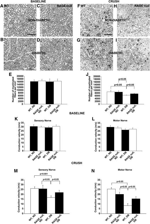 FIG. 1. Deletion of RAGE in diabetic mice restores effective axonal regeneration and improves nerve conduction velocity after acute sciatic nerve crush. Histological analysis shows sciatic nerve myelinated fibers 21 days after acute injury in nondiabetic and diabetic mice. A–E: Unlesioned nerve at baseline. F–J: Crushed nerve 21 days after surgery. Semithin sections reveal a significant difference in number of myelinated fibers per mm2 between WT and RAGE-null diabetic mice, indicating that RAGE deletion is beneficial for nerve regeneration in chronic hyperglycemia after injury. Scale bar: 50 µm2, n = 9 mice per group. K–N: Nerve conduction velocity (NCV) studies in unlesioned nerve at baseline (K, L) and acutely injured (M, N) nerve 21 days postcrush were performed. NCV analysis indicated that although there were no baseline differences, conduction velocity was significantly improved in RAGE-null diabetic mice compared with their WT diabetic counterparts; n = 15 mice per group.