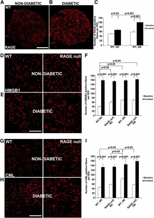 FIG. 2. Expression of RAGE and its ligands in diabetic peripheral nerve: baseline and postcrush injury. The indicated mouse groups were subjected to acute sciatic nerve crush injury and the indicated staining performed in (A, B, D, E, G, and H). A–C: RAGE in the sciatic nerve tissue 21 days postcrush injury. D–F: HMGB1 in the sciatic nerve tissue 21 days postcrush injury. G–I: CML-AGE in the sciatic nerve tissue 21 days postcrush injury. Similar staining was performed at baseline uncrushed state (not shown) and the results were subjected to quantification as illustrated by open bars; filled bars reflect crushed state. Scale bar: 100 µm; n = 5 mice per group. (A high-quality digital representation of this figure is available in the online issue.)