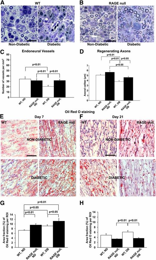 FIG. 3. Morphometric analysis of sciatic nerve regeneration. Number of endoneurial vessels and axonal caliber of regenerating axons were quantified in crushed sciatic nerve section of nondiabetic and diabetic mice 21 days postsurgery (A–D). Magnified images show endoneurial vessels (arrows) and size of regenerating axons (A, B), scale bar 25 µm. The number of vessels was significantly lower in the WT diabetic group as compared with its counterpart, and improved by RAGE deletion in diabetes (C). The shortest caliber of regenerating axons was noticed in the diabetic WT group (D); n = 9 per group. Oil-Red-O staining was performed on longitudinal nerve sections 7 and 21 days postsurgery (E–H). On day 7 (E, G), the most abundant staining was observed for the RAGE-null diabetic group, whereas on day 21 (F, H) the largest area of staining was observed for WT diabetic group. Scale bar: 50 µm, n = 5. (A high-quality digital representation of this figure is available in the online issue.)