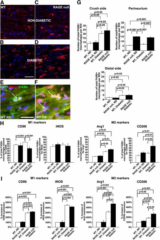 FIG. 4. Macrophage infiltration and polarization in diabetes and crush injury: effect of RAGE. The indicated groups of mice were subjected to diabetes or nondiabetes state; on day 7 after injury, tissue was retrieved and the indicated immunostaining experiments were performed as follows. A–D: Immunofluorescence staining for F4/80 (red) and DAPI (nuclei) staining of sciatic nerve cross-section in the indicated mouse groups 7 days after injury. Scale bar: 50 µm. E and F: Representative images of sciatic nerve cross-sections multistained for RAGE (red) and F4/80 (green) and DAPI (blue). Scale bar 25 µm. G: Statistical analysis of macrophage infiltration at three different sections of the nerve. Results are reported as total macrophage number per ROI as determined by F4/80 staining. H and I: Invading macrophages were stained for M1 and M2 markers (M1, CD86, and iNOS) and (M2, Arg1, and CD206). H: Results are depicted as the percent of total macrophages costained for individual markers. I: Results for M1 and M2 markers are depicted by setting the WT nondiabetic condition as 100% for reference and all other groups compared with this condition; n = 6 mice per condition. (A high-quality digital representation of this figure is available in the online issue.)