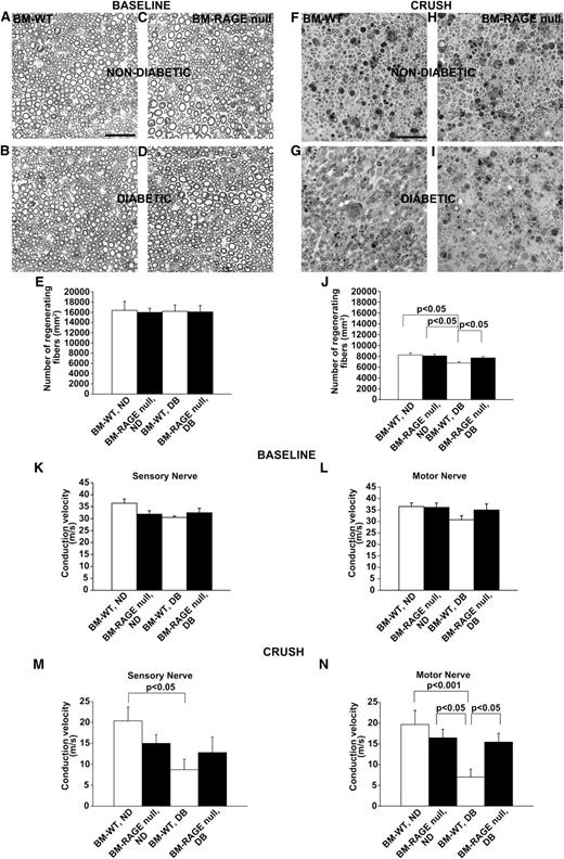 FIG. 5. Deletion of RAGE in bone marrow in diabetic mice restores effective axonal regeneration and improves conduction velocity after acute sciatic nerve crush. Histological analysis of sciatic nerve myelinated fibers 21 days after acute injury in WT mice subjected to lethal irradiation and reconstitution with the indicated bone marrow (WT or RAGE-null) followed 4 weeks later by induction of diabetes or nondiabetic state. A–E: Unlesioned nerve at baseline. F–J: Crushed nerve 21 days postsurgery. Semithin sections reveal a significant difference in number of myelinated fibers per mm2 between WT mice reconstituted with RAGE-null compared with WT bone marrow in the diabetic state, indicating that transplantation of RAGE-deficient bone marrow is beneficial for nerve regeneration in diabetes after injury. Scale bar: 50 µm, n = 8 mice per group. K–N: Nerve conduction velocity (NCV) in unlesioned nerve at baseline (K, L) and acutely injured (M, N) nerve 21 days postsciatic nerve crush. NCV analysis 21 days postcrush indicated that conduction velocity is significantly improved in WT diabetic mice reconstituted with RAGE-null compared with WT bone marrow; n = 15 mice per group.