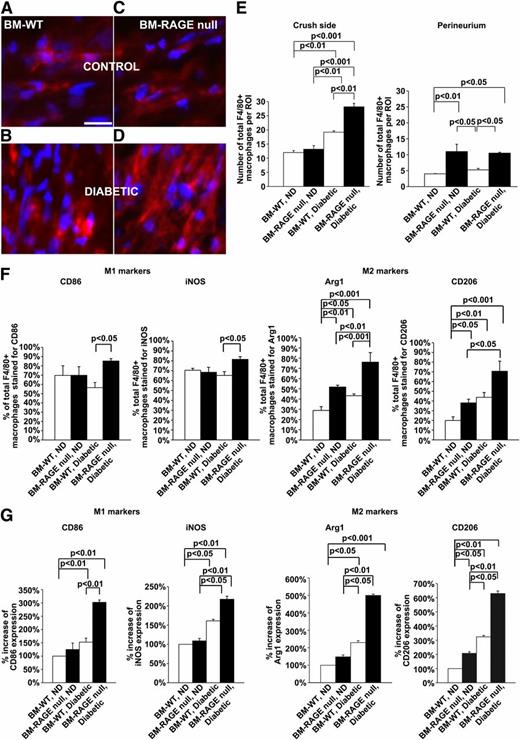 FIG. 6. Macrophage infiltration and polarization in diabetes and crush injury: effect of bone marrow RAGE expression. The indicated groups of mice were subjected to diabetes or nondiabetes state; on day 7 after injury, tissue was retrieved and the indicated immunostaining experiments were performed as follows. A–D: Immunofluorescence staining for F4/80 (red) and DAPI (nuclei) staining of sciatic nerve cross-section in the indicated mouse groups 7 days after injury. Scale bar: 25 μm. E: Statistical analysis of macrophage infiltration at two different sections of the nerve. Results are reported as total macrophage number per ROI as determined by F4/80 staining. F: Invading macrophages were stained for M1 and M2 markers (M1, CD86, and iNOS) and (M2, Arg1, and CD206). Results are depicted as the percent of total macrophages costained for individual markers. G: Results are depicted by setting the WT nondiabetic condition as 100% for reference and all other groups compared with this condition; n = 6 mice per condition. (A high-quality digital representation of this figure is available in the online issue.)