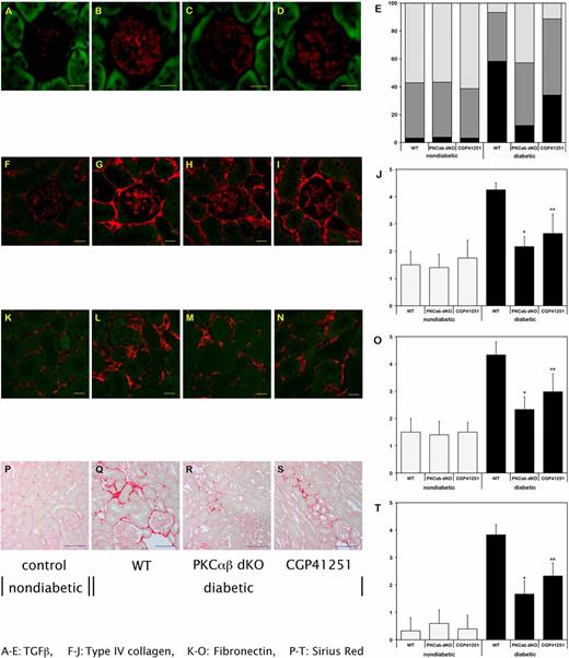 FIG. 2. Expression levels of TGF-β1 (A–E), type IV collagen (F–J), and fibronectin (K–O), as well as Sirius red staining (P–T), in the glomerulus/renal cortex of nondiabetic and diabetic WT mice, and of diabetic PKC-α/β−/− (dKO) mice and diabetic mice treated with CGP41251 (1 mg/kg) after 8 weeks of hyperglycemia. *P < 0.01 vs. WT; **P < 0.05 vs. WT.