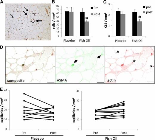 FIG. 2. Effects of FO treatment on adipose macrophages and capillaries. Before and after treatment with FO, adipose tissue from biopsies was analyzed histochemically. A: CD68 staining. A representative image showing macrophages (small arrows) and crown-like structures (large arrow). Data are expressed as mean ± SEM. B: Effects of FO and placebo on macrophage number (*P < 0.05 vs. pretreatment). C: Effects of treatment on the number of crown-like structures (CLS) (*P < 0.05 vs. pretreatment). D: Capillary and large vessels were identified by staining with lectin and α-smooth muscle actin, and representative images are shown. E: Effects of placebo and FO on the number of capillaries in adipose tissue.