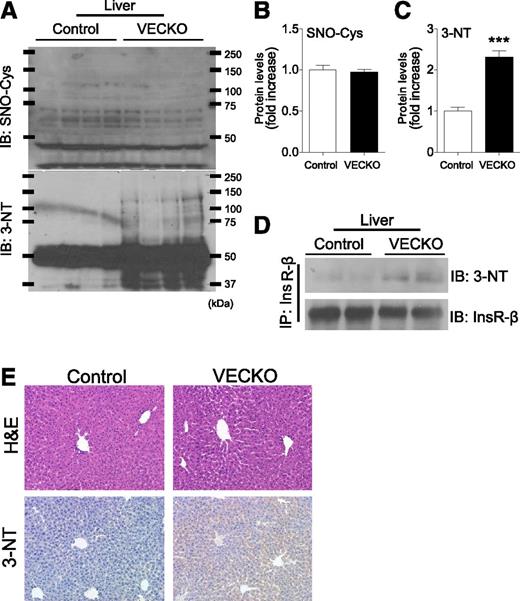 FIG. 5. InsR nitration in liver. A: Immunoblots (IB) and quantification of S-nitrosylation (SNO-Cys) (B) and nitrotyrosine (3-NT) (C) in liver from 12-week-old WT and VECKO mice (n = 4). D: Immunoblots of nitrotyrosine in liver tissue after immunoprecipitation with InsR. E: Representative photographs of hematoxylin-eosin (H&E) and immunostaining of nitrotyrosine in liver sections. (A high-quality color representation of this figure is available in the online issue.)