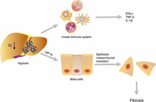FIG. 2. Islet loss by hypoxia. The low oxygen tension of the liver parenchyma enhances hypoxia (4). Hypoxia triggers the innate immune system resulting in the release of the cytokines IFN-γ, TNF-α, and IL-1β, which are harmful for islets (7). Furthermore, β-cells undergo an epithelial-to-mesenchymal transition under hypoxic conditions. This transition is provoked by HIF-1α activation, which mediates Twist expression (8). Twist expression contributes to the development of fibrosis.