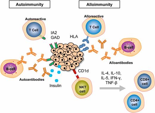 FIG. 5. Adaptive responses against human islet allografts in the liver. Pretransplant autoantibodies and autoreactive T-cells are triggered by antigens such as IA2, GAD, and insulin (15,16). HLA is recognized by alloreactive cytotoxic T-cell precursors and antibodies (3). Furthermore, the high amount of NKT cells in the liver with alloreactivity can expedite the allograft rejection process via nonclassical MHC molecules such as CD1d. Secretion of IL-4, IL-10, IL-5, IFN-γ and TNF-β activates the CD4 T helper 1 cells, CD8 cytotoxic T-cells leading to graft failure (17). Notably, NK and NKT cells are not suppressed by the currently applied immunosuppressants.