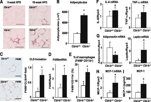 FIG. 1. Early recruitment of macrophages into epididymal WAT in Cbl-b−/− mice fed the HFD. A: The WAT of Cbl-b+/+ (n = 4) and Cbl-b−/− mice (n = 4) fed the HFD for 5 or 18 weeks was stained with hematoxylin and eosin. Scale bar = 100 μm. B: Mean adipocyte cross-sectional area (μm2) was assessed on A. Data are mean ± SD (n = 4). *P < 0.05 compared with Cbl-b+/+ mice. C: The slides of WAT from Cbl-b+/+ and Cbl-b−/− mice fed the HFD for 18 weeks, prepared as described above, were subjected to immunohistochemistry for F4/80, a macrophage marker. Immunoreactivity for F4/80 was visualized by diaminobenzidine staining. The number of CLS was counted in 15 high-power (HP) fields in seven slides per mice. Data are mean ± SD (Cbl-b+/+, n = 3; Cbl-b−/−, n = 3). *P < 0.05 compared with Cbl-b+/+ mice. Scale bar = 100 μm. D: Real-time RT-PCR analysis of F4/80 expression in WAT from Cbl-b+/+ and Cbl-b−/− mice fed the HFD for 5 weeks. The level of transcript was normalized to that in Cbl-b+/+ mice. Data are mean ± SD (Cbl-b+/+, n = 5; Cbl-b−/−, n = 4). *P < 0.05 compared with Cbl-b+/+ mice. E: Proportions of F4/80 and CD11b double-positive cells to total cells in SV fractions from WAT of Cbl-b+/+ and Cbl-b−/− mice fed the HFD for 5 weeks analyzed by flow cytometry. Data are mean ± SD (Cbl-b+/+, n = 4; Cbl-b−/−, n = 3). *P < 0.05 compared with Cbl-b+/+ mice. Expression of cytokines and chemokines in WAT of Cbl-b+/+ and Cbl-b−/− and mice fed the HFD for 5 weeks. Real-time RT-PCR analysis of the expression levels of IL-6 and TNF-α (F), adiponectin and leptin (G), and MCP-1 transcripts (H) in WAT of Cbl-b+/+ and Cbl-b−/− mice fed the HFD for 5 weeks. The level of each transcript was normalized to that in Cbl-b+/+ mice. Data are mean ± SD (Cbl-b+/+, n = 5; Cbl-b−/−, n = 4). I: Serum concentrations of MCP-1 in Cbl-b+/+ and Cbl-b−/− mice fed the HFD for 5 weeks measured by ELISA. Data are mean ± SD (Cbl-b+/+, n = 3; Cbl-b−/−, n = 4). *P < 0.05 compared with Cbl-b+/+ mice.