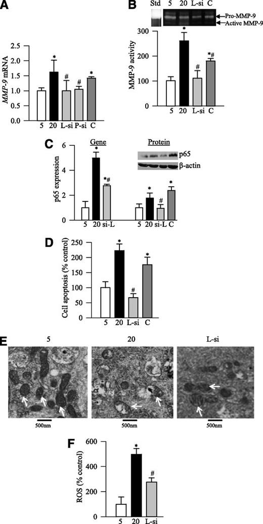 FIG. 6. LSD1 siRNA of retinal endothelial cells prevents glucose-induced increase in MMP-9, p65, cell apoptosis, and ROS and protects mitochondrial damage. Cells transfected with LSD1 or p65 siRNA or scramble RNA were exposed to high glucose for 4 days. A: MMP-9 gene expression was quantified by SYBR green–based qPCR. B: MMP-9 activity was measured in the incubation medium by in situ zymography using pro-MMP-9 (human recombinant) as a marker. The active form of MMP-9 (82–86 kDa) relative to the latent form (92 kDa) was quantified and is presented in the accompanying histogram. C: Gene expression and protein level of the p65 subunit of NF-κB were quantified by qPCR and Western blot techniques, respectively, using β-actin as an internal control. D: Cell apoptosis was measured using an assay kit from Roche Diagnostics. ELISA for cytoplasmic histone-associated DNA fragments was performed. E: Morphology of the mitochondria was determined by electron microscopy using ultrathin sections of the cells embedded in 812 resin. Mitochondria were analyzed by ImageJ software in 8–10 images per sample and three to five samples per group. Arrows indicate the mitochondria, and the bars represent 500 nm. F: ROS levels were quantified fluorometrically using DCDHF. 5 and 20, cells incubated in 5 or 20 mmol/L glucose for 4 days; L-si, P-si, and C, cells transfected with LSD1-siRNA, p65-siRNA, or scramble RNA, respectively, and incubated in 20 mmol/L glucose. Values obtained from untransfected control cells that were incubated in 5 mmol/L glucose are considered as 1 or 100%. *P < 0.05, compared with 5 mmol/L glucose; #P < 0.05, compared with 20 mmol/L glucose.