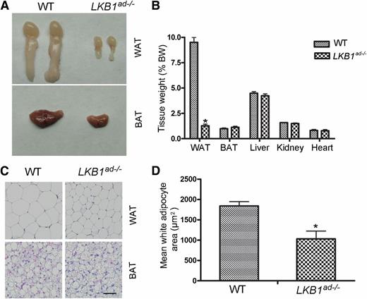 FIG. 2. Deletion of LKB1 in mice inhibits the formation of WAT. A: Appearance of the epidydimal fat pad and BAT of WT and LKB1ad−/− mice at the age of 18 days. B: Weight of various organs relative to overall body weight in WT and LKB1ad−/− mice at 18 days after birth. C: WAT and BAT from 18-day-old male WT and its LKB1ad−/− littermate were stained with H&E. Scale bar, 50 µm. D: Adipocyte size was measured using images of WAT sections (n > 100 cells/group). *P < 0.05 compared with WT. (A high-quality color representation of this figure is available in the online issue.)