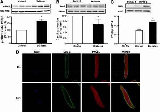 FIG. 1. Expression of PKCβ2 and Cav-3 in cardiomyocytes isolated from control and STZ-induced diabetic rats (8 weeks). A: Representative Western blot demonstrating p-PKCβ2 (Ser660) and total PKCβ2 expression. B: Representative Western blot demonstrating Cav-3 expression with glyceraldehyde-3-phosphate dehydrogenase (GAPDH) as loading control. C: Cell lysates containing equal amounts of total protein were subjected to immunoprecipitation (IP) with anti–Cav-3 antibody (Ab) and analyzed by immunoblot (IB) with PKCβ2 and Cav-3 antibody. All results are expressed as means ± SEM. n = 6–8 per group. *P < 0.05 vs. control. D: Confocal laser microscopic image of adult rat cardiomyocytes in response to HG. Isolated cardiomyocytes from nondiabetic rats were incubated with LG or HG for 36 h and underwent standard immunofluorescent staining with PKCβ2 and Cav-3 antibodies (see research design and methods).