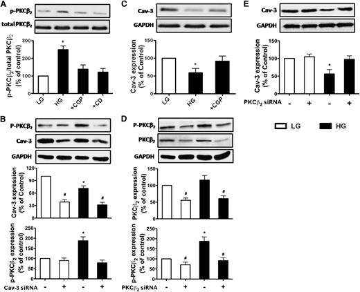 FIG. 3. Expression of p-PKCβ2 and Cav-3 in cultured cardiomyocytes and H9C2 cells after various treatments in LG (5.5 mmol/L) or HG (25 mmol/L) conditions for 36 h. A: Representative Western blot demonstrating p-PKCβ2 (Ser660) in comparison with total PKCβ2 in cardiomyocytes exposed to HG in the presence of a selective PKCβ2 inhibitor, CGP (1 μmol/L), or CD (10 μmol/L). B: Representative Western blot demonstrating p-PKCβ2 and Cav-3 expression in H9C2 cells transfected with Cav-3 siRNA exposed to LG or HG. C: Representative Western blot demonstrating Cav-3 expression in cultured cardiomyocytes exposed to HG in the presence of CGP (1 μmol/L). D: Representative Western blot demonstrating p-PKCβ2, total PKCβ2 expression, and Cav-3 expression in H9C2 cells transfected with PKCβ2 siRNA in LG or HG conditions. Glyceraldehyde-3-phosphate dehydrogenase (GAPDH) served as loading control. All results are expressed as means ± SEM. n = 7. *P < 0.05 vs. all other groups, #P < 0.05 vs. control and siRNA-treated groups.