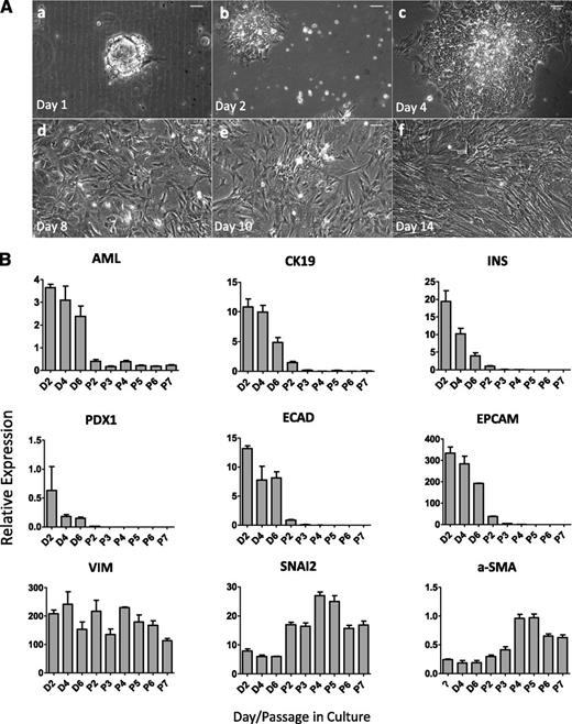FIG. 1. Pancreatic exocrine fractions dedifferentiate toward mesenchymal cells in culture. A: Phase contrast images of exocrine fractions when cultured in tissue culture dishes over a 14-day period. Scale bar = 50 µm. B: QRT-PCR analysis of pancreatic, epithelial, and mesenchymal markers in cultured exocrine fractions from day 2 up to passage 7 after plating in tissue culture dishes. Data are presented as mean ± SEM. Expression levels are relative to glyceraldehyde 3-phosphate dehydrogenase (n = 3). AML, amylase; a-SMA, α-smooth muscle actin; D, day; ECAD, E-cadherin; EPCAM, epithelial cell adhesion molecule; INS, insulin; P, passage; SNAI2, snail homolog 2; VIM, vimentin.