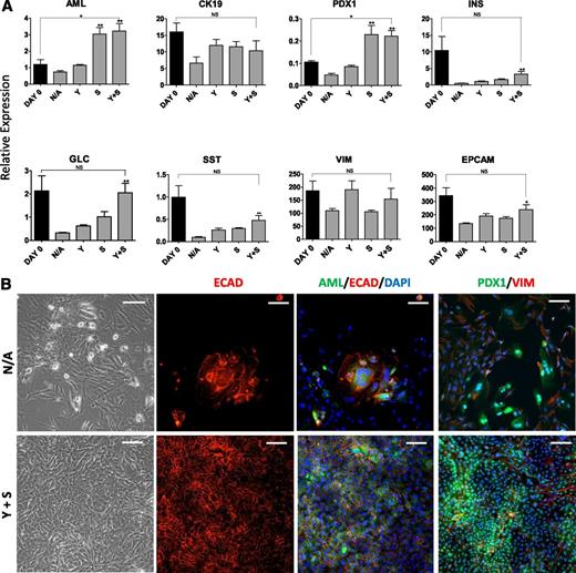 FIG. 6. The Rho-kinase and TGF-β1 pathway inhibitors suppress dedifferentiation of cultured pancreatic exocrine cells. A: Unpassaged exocrine pancreatic cells were plated in tissue culture dishes. After 48 h to allow attachment, cells were untreated (N/A) or treated with 2 μmol/L ρ-kinase inhibitor Y27632 (Y) and 10 μmol/L TGF-β1 inhibitor SB431542 (S) individually or in combination, and the cells were incubated for another 5 days. Treated and N/A cells as well as baseline samples after 48 h in culture (day 0) were then harvested and RNA was extracted for QRT-PCR analysis for expression of pancreatic, epithelial, and mesenchymal markers. Data are expressed relative to glyceraldehyde 3-phosphate dehydrogenase and presented as mean ± SEM (n = 3). A one-way ANOVA was performed with Dunnet post hoc test comparing treatment groups with N/A. A t test was used to compare day 2 with Y + S. For all analyses, *P < 0.05, **P < 0.01. B: Immunocytochemistry for the pancreatic markers amylase (AML) and Pdx1, the epithelial marker E-cadherin (ECAD), and the mesenchymal marker vimentin (VIM) in cultured exocrine pancreatic cells after 10 days in the presence of Y27632 and SB431542 (Y+S). N/A cells also were analyzed for the same markers. Nuclei were counterstained with DAPI. Scale bar = 20 μm. EPCAM, epithelial cell adhesion molecule; GLC, glucagon; INS, insulin; SST, somatostatin.