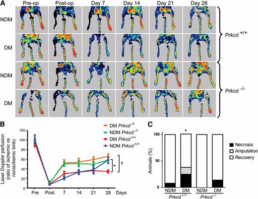 FIG. 1. Blood flow reperfusion and recovery limb from ischemia. Laser Doppler imaging and reperfusion analysis of diabetic (DM) and nondiabetic (NDM) Prkcd+/+ and Prkcd−/− mice. A and B: Morphological and observational analysis of necrosis and amputation of ischemic limbs after surgery. C: Results are shown as mean ± SD of 10–12 mice per group. *P = 0.0046 vs. NDM Prkcd+/+, †P = 0.0003 vs. DM Prkcd−/−.