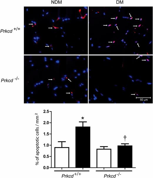 FIG. 2. Vascular cell apoptosis analysis in ischemic muscles. Immunofluorescence of apoptotic-positive cells (red) and CD31 (blue) (top panels) and percentage of apoptotic cells (bottom panel) in the ischemic adductor muscles of nondiabetic (NDM, □) and diabetic (DM, ■) Prkcd+/+ and Prkcd−/− mice. Results are shown as mean ± SD of three sections of six to seven mice per group. White arrows represent colocalization of CD31 and the apoptotic-positive marker. *P = 0.05 vs. NDM Prkcd+/+, †P < 0.05 vs. DM Prkcd+/+.