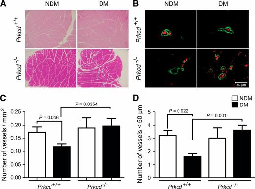 FIG. 3. Histological and vascular density analysis. Structural analysis of the ischemic muscles stained with hematoxylin and eosin (A) and immunofluorescence of endothelial cells (red) and α-smooth muscle actin (green) labeling (B) in the ischemic adductor muscles of nondiabetic (NDM) and diabetic (DM) Prkcd+/+ and Prkcd−/− mice. Quantification of the vascular density (C) and the number of vessels smaller than 50 µm (D). Results are shown as mean ± SD of three sections of six mice per group.