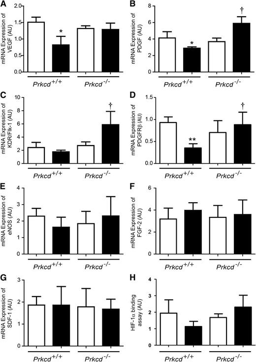 FIG. 6. mRNA expression of angiogenic factors. Quantitative real-time PCR of VEGF (A), PDGF (B), KDR/Flk-1 (C), PDGFR-β (D), eNOS (E), FGF-2 (F), and SDF-1 (G) mRNA expression and nuclear transcriptional factor activity of HIF-1α (H) in ischemic adductor muscles of nondiabetic (NDM, □) and diabetic (DM, ■) Prkcd+/+ and Prkcd−/− mice. Results are shown as mean ± SD of six to seven mice. *P = 0.05 vs. NDM Prkcd+/+, **P < 0.01 vs. NDM Prkcd+/+, †P < 0.05 vs. DM Prkcd+/+.