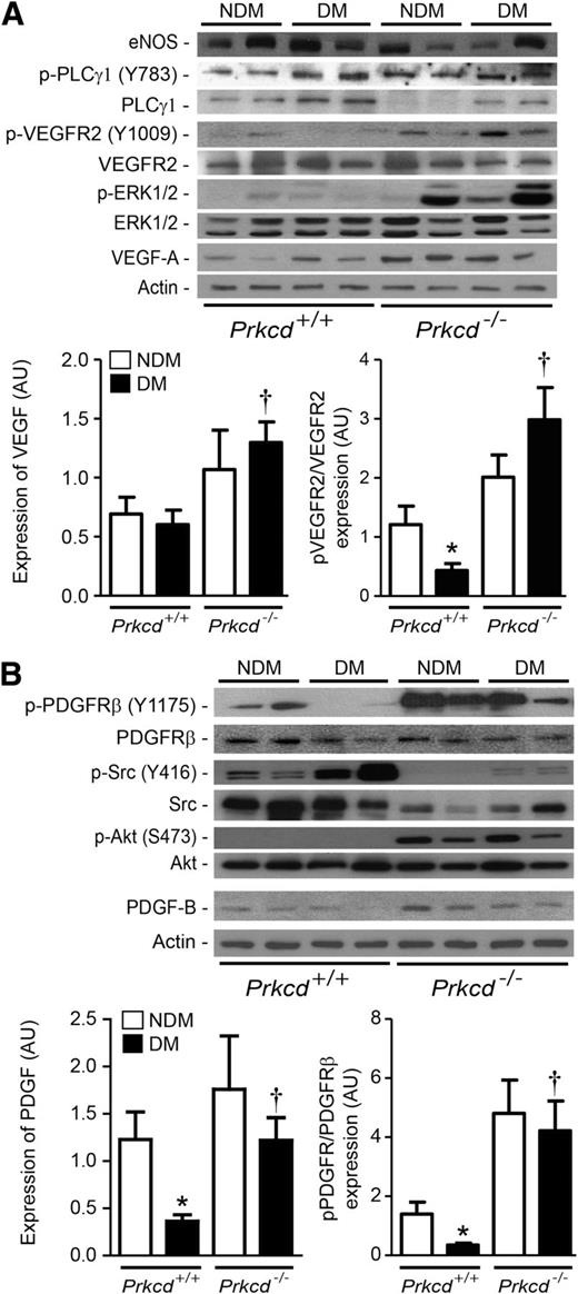 FIG. 7. Increased expression and activity of the VEGF and PDGF signaling pathway in diabetic (DM) and nondiabetic (NDM) Prkcd−/− mice. Expression of eNOS, PLCγ1, p-PLCγ1, VEGF-A, p-VEGFR2, VEGFR2, ERK1/2, p-ERK1/2 (A), and PDGF-B, p-PDGFR-β, PDGFR-β, Src, p-Src, Akt, p-Akt, and actin (B) in ischemic adductor muscles of Prkcd+/+ and Prkcd−/− mice. Protein expression was detected by Western blot, and densitometric quantitation was measured. Results are shown as mean ± SD of four to six independent experiments. *P = 0.05 vs. NDM Prkcd+/+, †P < 0.05 vs. DM Prkcd+/+.
