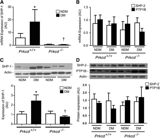 FIG. 8. Increased expression of SHP-1 in ischemic adductor muscles of diabetic (DM) and nondiabetic (NDM) mice. Quantitative real-time PCR of SHP-1 (A), SHP-2, and PTP1B mRNA (B), and protein expression of SHP-1 (C), SHP-2, PTP1B, and their corresponding loading control (actin) (D) in ischemic adductor muscles of NDM and DM Prkcd+/+ and Prkcd−/− mice. Protein expression was detected by immunoblot, and densitometric quantitation was measured. Results are shown as mean ± SD of four to six independent experiments. *P = 0.05 vs. NDM Prkcd+/+, †P < 0.05 vs. DM Prkcd+/+.