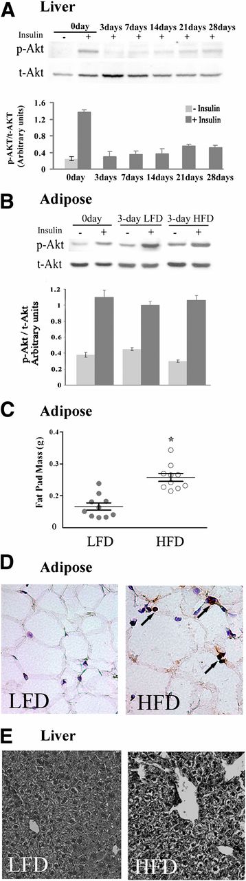 FIG. 1. Short-term HFD induces liver, but not adipose tissue insulin resistance. A: Liver insulin resistance was determined by impaired insulin-stimulated p-Akt on serine 473 after intravenous injection of insulin. Representative immunoblot of p-Akt in liver lysates from mice at day 0 up to day 28 on HFD compared with liver lysates of a mouse that was not treated with insulin (–). After densitometry analysis, the ratio of the intensity of the p-Akt band to total Akt (t-Akt) was calculated and presented, as arbitrary units, by the mean ± SEM of 10 mice studied in three independent experiments. +, treated with insulin. B: Normal insulin signaling in epididymal fat of 3-day HFD mice. A representative immunoblot of p-Akt in epididymal fat tissue lysates from mice at day 0, and HFD and control mice on LFD at day 3. Densitometry analysis was performed as in A. Results are mean ± SEM of 15 mice studied in five independent experiments. C: Epididymal fat mass of 10 mice fed the HFD and 10 mice fed the LFD at day 3 of the diet show a significant difference. *P < 0.001 between the groups. Results are mean ± SEM of two different experiments. D: Histological sections of epididymal adipose tissues and immunolocalization of neutrophils (shown by arrows) using anti-NIMP-R14 antibodies and hematoxylin counterstaining (original magnification ×400). E: Histological sections of liver stained by hematoxylin and eosin (original magnification ×200). Shown are representative images of 10 mice in each group.