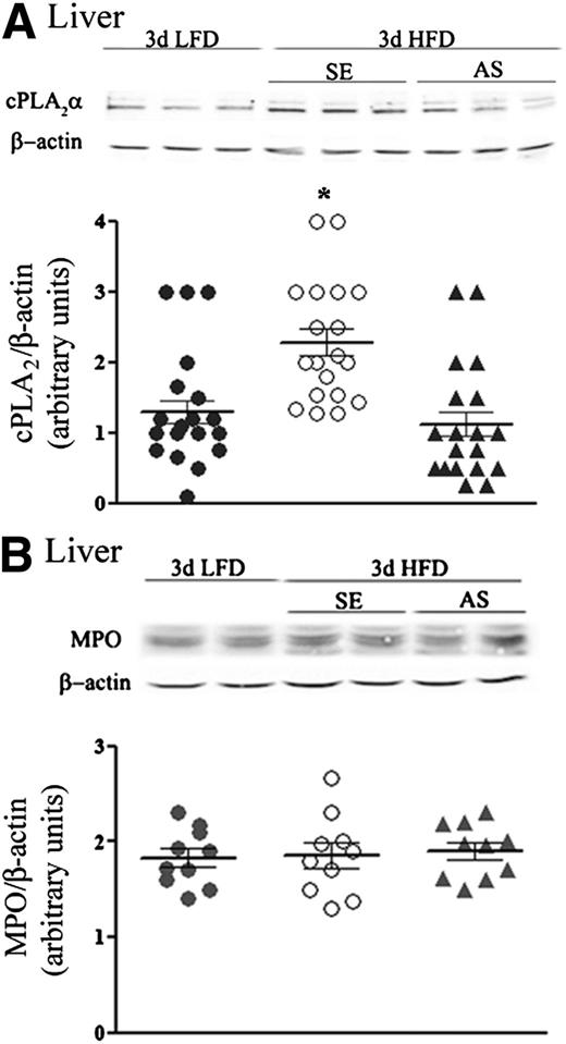FIG. 3. The effect of cPLA2α AS treatment in livers of HFD mice. A: A representative immunoblot analysis of cPLA2α and the corresponding β-actin protein expression in liver lysates of the different groups of mice. Densitometry analysis for cPLA2α was performed as in Fig. 2B. *P < 0.001 significant increase of control HFD mice (SE) compared with HFD mice with AS treatment or LFD mice. B: A representative immunoblot of MPO in liver of LFD mice, control HFD mice (SE), and AS-treated HFD mice. Densitometry analysis for MPO was performed as in Fig. 2C. There are no differences among the various groups of mice. d, day.