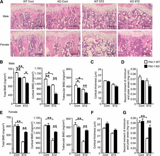 FIG. 2. Effects of PAI-1 deficiency on diabetic bone loss in both sexes of mice. Hematoxylin-eosin staining of tibia in control and streptozotocin-treated male and female PAI-1 WT and KO mice (A). BMD values in total, trabecular, and cortical bones (B); cortical thickness (C); and second moment of minimum and polar areas (D) of tibia in control and streptozotocin-treated male PAI-1 WT and KO mice. BMD values in total, trabecular, and cortical bones (E); cortical thickness (F); and second moment of minimum and polar areas (G) of tibia in control and streptozotocin-treated female PAI-1 WT and KO mice. For assessment of trabecular BMD, trabecular regions of interest extended from 96 um distal to the end of the proximal growth plate over 1.5 mm toward the diaphysis. For assessment of cortical BMD and thickness, cortical ROIs were defined as 2.0-mm segments of the mid-diaphysis tibia. For assessment of total BMD and bone strength index (second moment of minimum and polar areas: index of bending strength), ROIs were defined as 9,600-μm segment (100 slices) from distal end of proximal growth plate of tibia. Parameters used for the CT scans were as follows: tube voltage, 50 kVp; tube current, 500 μA; integration time, 3.6 ms; axial field of view, 48 mm; and voxel size of 48 × 96 μm with a slice thickness of 96 μm. Bone parameters were analyzed using the LaTheta software (version 3.40). Results are expressed as means ± SEM. *P < 0.05, **P < 0.01 (n = 5–7 in each group). Cont, control; STZ, streptozotocin.