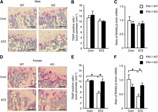 FIG. 4. Effects of PAI-1 deficiency on bone resorption in tibia of both sexes of diabetic mice. TRAP staining (A) and number of TRAP-positive multinucleated cells (B) in tibia of control and streptozotocin-treated male PAI-1 WT and KO mice. Results are expressed as means ± SEM. *P < 0.05 (n = 5–7 in each group). Levels of RANKL mRNA (C) in tibia of control and streptozotocin-treated male PAI-1 WT and KO mice. Results are expressed relative to β-actin mRNA values and expressed as means ± SEM. *P < 0.05 (n = 5–7 in each group). TRAP staining (D) and number of TRAP-positive multinucleated cells (E) in tibia of control and streptozotocin-treated female PAI-1 WT and KO mice. Results are expressed as means ± SEM. *P < 0.05 (n = 5–7 in each group). Levels of RANKL mRNA (F) in tibia of control and streptozotocin-treated female PAI-1 WT and KO mice. Results are expressed relative to β-actin mRNA values and expressed as means ± SEM. *P < 0.05 (n = 5–7 in each group). Cont, control; STZ, streptozotocin.