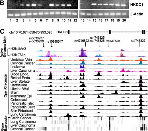 FIG. 1. A: LocusZoom plot of association results and LD boundaries around HKDC1. The top panel reflects the meta-analysis results of the four GWAS cohorts. Each of the four middle panels contains the population-specific (AC, EU, HI, TH) association results and estimates of LD (D′) from the SNP with the strongest evidence for association in the meta-analysis. The LD estimates are color coded as a heat map from purple (D′ ≥0.3 to >0.4) to red (D′ ≥0.9 to >1.0), whereas gray indicates D′ <0.3. These coincide with the recombination hotspots indicated by the blue lines (recombination rate in genetic distance between markers [cM]/physical distance [Mb] from HapMap (12). The bottom panel shows the genes and their directions in this region of chromosome 10. B: HKDC1 mRNA in human tissues as determined by RT-PCR: (1) adipose tissue, (2) bladder, (3) brain, (4) cervix, (5) colon, (6) esophagus, (7) heart, (8) kidney, (9) liver, (10) lung, (11) ovary, (12) placenta, (13) prostate, (14) skeletal muscle, (15) small intestine, (16) spleen, (17) testes, (18) thymus, (19) thyroid, and (20) trachea. C: Aligned genes, SNPs, active enhancer marks, OC regions, and gene expression profiles of the 2HPG-associated HKDC1 region on chromosome 10. SNPs upstream and within HKDC1 align with peaks representing regions enriched for active histone marks and OC regions in cell types representing 16 different tissues. HKDC1 is highly expressed in colon, lung, liver, and cervical carcinomas.