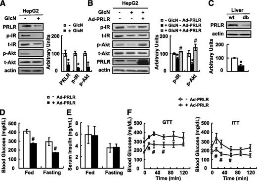 FIG. 5. Overexpression of PRLR by Ad-PRLR improves insulin sensitivity under insulin-resistant conditions. A and B: HepG2 cells were exposed to Ad-PRLR (+ Ad-PRLR) or GFP (− Ad-PRLR) for 48 h prior to being incubated with (+ GlcN) or without (− GlcN) 18 mmol/L glucosamine for 18 h in the presence of Ad, followed by stimulation with 100 nmol/L insulin for 20 min. C: PRLR protein was analyzed by Western blot in the livers of wild-type (wt) and db/db (db) mice. D–F: Male C57BL/6J db/db mice were infected with Ad-PRLR (+ Ad-PRLR) or GFP (− Ad-PRLR) via tail-vein injection, followed by measurement of blood glucose and serum insulin levels at days 11 and 7 in D and E, and performance of GTTs and ITTs at days 7 and 9 in F, respectively. The mean ± SEM values shown are representative of at least three independent in vitro experiments or at least two independent in vivo experiments, with the number of mice included in each group in each experiment indicated (n = 5–7). Statistical significance was calculated using the two-tailed Student t test or one-way ANOVA followed by the SNK test for the effects of insulin-resistant vs. control group (*P < 0.05) in A--C, Ad-PRLR vs. the control group under insulin resistance (#P < 0.05) in B and D–F. A and B: PRLR, p-IR (tyr1150/1151), and p-Akt (ser473) protein (left, Western blot; right, quantitative measurements of PRLR, p-IR, and p-Akt protein relative to actin or their total protein). C: PRLR protein (top, Western blot; bottom, quantitative measurements of PRLR protein relative to actin). D: Blood glucose levels. E: Serum insulin levels. F: GTT and ITT. t, total.