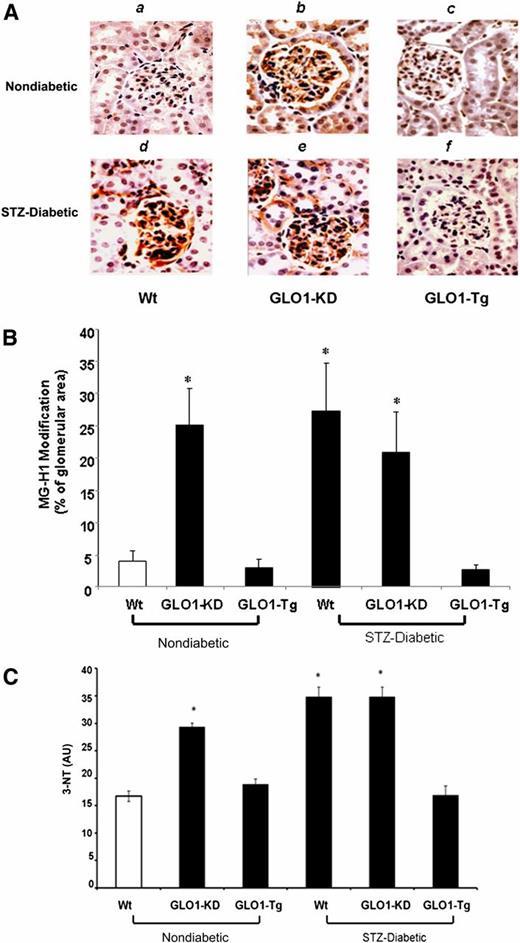 Figure 1. Immunohistochemistry of glomerular MG-modified proteins and kidney oxidative stress (n = 5). A: Representative photomicrographs of MG-H1 immunostaining from kidneys of nondiabetic (top panel) and diabetic (bottompanel) Wt (a,d), GLO1-KD (b,e), and GLO1-Tg (c,f) mice. Original magnification ×600. B: Quantitation of MG-H1 immunostaining using image analysis software for each group of mice. C: Kidney 3-NT levels from nondiabetic and diabetic Wt, GLO1-KD, and GLO1-Tg mice. Data are expressed as mean ± SD (*P < 0.05 vs. Wt, ANOVA). AU, arbitrary units.