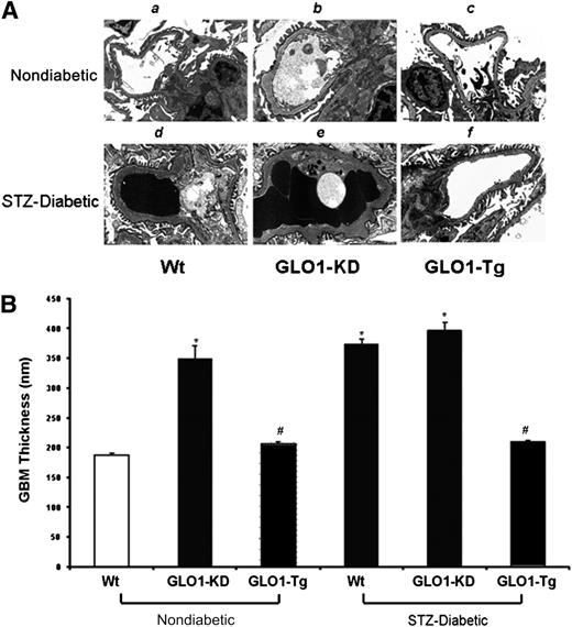 Figure 4. Measurement of GBM thickness (n = 15). A: Representative electron micrographs of glomeruli from kidneys of nondiabetic and diabetic Wt (a,d), GLO1-KD (b,e), and GLO1-Tg mice (c,f). Original magnification ×12,000. B: Quantitation of GBM thickness. Data are expressed as mean ± SD (*P ≤ 0.05 vs. Wt; #P < 0.05 vs. STZ-Wt; ANOVA).