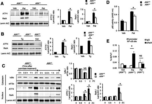 Figure 4. ATF4 is involved in NF-κB activation in response to metabolic stresses. A and B: Western blotting of nuclear extracts from peritoneal macrophages. Representative blots (left) and quantitative results (right) are shown (*P < 0.05, n = 4–5). A: Cells were treated with 500 μmol/L palmitate (Pal) or BSA (Veh) for 6 h. B: Cells were treated with 1 μmol/L thapsigargin (Tg) or DMSO (Veh) for 2 h. C: Earlier kinetics of Pal-induced changes in the NF-κB pathway. Western blotting of cytoplasmic (for IκBα and eIF2α) and nuclear (for ATF4, RelA, and lamin A/C) fractions from peritoneal macrophages treated with 500 μmol/L Pal for indicated times. Representative blots (left) and quantitative results (right) are shown (*P < 0.05, n = 4). D: NF-κB activity assay. Atf4+/+ and Atf4+/− peritoneal macrophages were treated with 500 μmol/L Pal or BSA (Veh) for 4 h. NF-κB p65/RelA activity in the nuclear extract was measured (*P = 0.0295, n = 3). E: A chromatin immunoprecipitation assay using Atf4+/+ and Atf4+/− peritoneal macrophages. Cells were treated with 500 μmol/L Pal or BSA (Veh) for 4 h (*P = 0.0349, n = 3). Chromatin was immunoprecipitated and quantitated by PCR analysis of the region neighboring an NF-κB site on the Il6 promoter. IκBα, inhibitor of nuclear factor κBα.