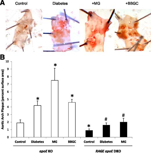 Figure 5. Plaque accumulation in the aortic arch (A), as assessed percentage area staining positive for Sudan IV (B) in apoE KO mice and RAGE/apoE double KO mice with and without 6 weeks of diabetes or exposure to MG or BBGC. *P < 0.05 vs. control, #P < 0.05 vs. RAGE apoE double KO mice.