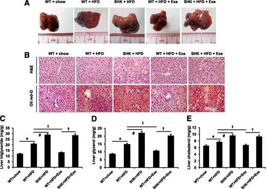 Figure 2. Exenatide-ameliorated liver steatosis disappears in SIRT1+/− mice. A: General photographs show liver size. B: Liver sections with hematoxylin and eosin (H&E) staining (top row) and Oil Red O staining (bottom row). Photomicrographs were taken using a microscope with original magnification ×40. Hepatic triglyceride (C), glycerol (D), and cholesterol (E) contents were determined. Data are expressed as mean ± SEM (n = 5–12). *P < 0.05 WT+HFD vs. WT+chow; #P < 0.05 SHK+HFD vs. WT+HFD; §P < 0.05 WT+HFD+Exe vs. WT+HFD; †P < 0.05 SHK+HFD+Exe vs. WT+HFD+Exe. Exe, exenatide; SHK, SIRT1 heterozygous knockout mice.