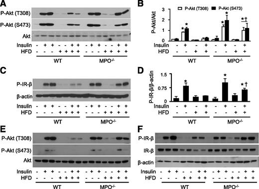 Figure 5. MPO deletion attenuates insulin resistance in epididymal WAT and liver. WT and MPO−/− mice fed the ND or HFD for 16 weeks were intraperitoneally injected with 2 units/kg insulin or saline alone. At 15 minutes after injection, homogenates of epididymal WAT were prepared, and levels of phosphorylated (P)-Akt-S473, P-Akt-T308, and P-IR-β were analyzed by Western blotting (A and C) and quantitated by densitometry (B and D). *P < 0.05 vs. WT control; †P < 0.05 WT vs. insulin-injected MPO−/−. The expression of P-Akt-S473, P-Akt-T308 (E), P-IR-β, and IR-β (F) in liver homogenates were measured by Western blotting.