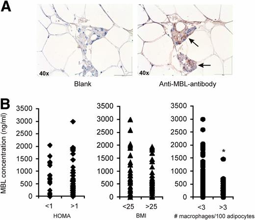 Figure 5. Low circulating concentrations of MBL in humans correspond to enhanced influx of macrophages in subcutaneous adipose tissue. A: Immunohistochemical staining of MBL in human subcutaneous adipose tissue. Arrows indicate MBL-positive cells. B: Circulating MBL concentrations classified according to HOMA (n = 72), BMI (n = 76), and macrophage influx (n = 74). *P < 0.05.