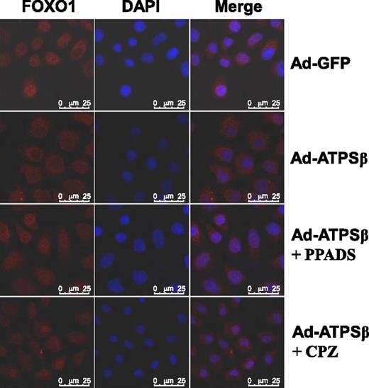 Figure 6. ATPSβ promoted nuclear exclusion of FOXO1 in HepG2 cells. In the absence of insulin, ATPSβ overexpression promoted translocation of FOXO1 from nucleus to cytoplasm, which was blocked by the P2 receptor antagonist PPADS or the CaM inhibitor CPZ. The images were obtained using confocal microscopy and are the representatives of at least three independent experiments.