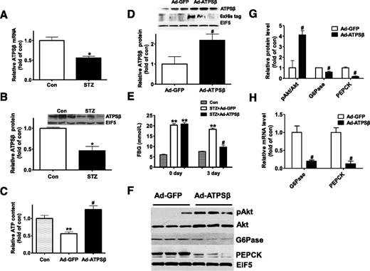 Figure 7. Hepatic overexpression of ATPSβ ameliorated fasting hyperglycemia in STZ-induced type 1 diabetic mice. The mRNA (A) and protein (B) levels of ATPSβ were reduced in the livers STZ-treated mice. n = 5, *P < 0.05 vs. control mice. C: Ad-ATPSβ treatment elevated ATP content in the livers. D: Ad-ATPSβ treatment increased the ATPSβ protein level in the livers of STZ-induced diabetic mice. E: Hepatic overexpression of ATPSβ ameliorated fasting hyperglycemia of STZ-treated mice. FBG was monitored 3 days after viral injection. F and G: ATPSβ overexpression increased pAkt levels and reduced the protein levels of G6Pase and PEPCK in the livers. H: ATPSβ overexpression reduced the mRNA levels of G6Pase and PEPCK in the livers. n = 9, *P < 0.05, **P < 0.01 vs. control mice; #P < 0.05 vs. Ad-GFP–treated mice.