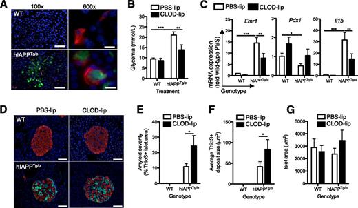 Figure 7. Improvement of hIAPP-induced hyperglycemia is accompanied by accumulation of mature amyloid fibrils in clodronate liposome–treated mice. A: Islets from 24-week-old FVB×C57BL/6 mice expressing the agouti viable yellow allele were examined to confirm amyloid formation. Representative low power (left) and high power (right) magnification fluorescence micrographs show staining for F4/80 (red), amyloid (thioflavin-S, green), and nuclei (DAPI, blue). Scale bar = 30 μm (left) or 5 μm (right). B: Twenty-week-old FVB×C57BL/6 mice expressing the agouti viable yellow allele were treated with 100 mg/kg clodronate-containing liposomes (CLOD-lip) or PBS-containing liposomes (PBS-lip) intraperitoneally every 4 days for 4 weeks. Fasting blood glucose was assessed at 24 weeks of age. White bars, PBS-lip; black bars, CLOD-lip. C: Islets were isolated at 24 weeks of age, and mRNA expression of the indicated markers was assessed by RT-qPCR. Expression levels were normalized to the housekeeping gene Rplp0. D: Pancreata were fixed at 24 weeks of age and assessed for amyloid severity. Representative fluorescence micrograph shows staining for insulin (red), amyloid (thioflavin-S, green), and nuclei (DAPI, blue). Scale bar = 50 μm. Thioflavin-S+ (ThioS+) area relative to total islet area (E), average amyloid deposit area (F), and islet size (G) was determined by image analysis. Data are mean ± SEM of four to seven mice per group. *P < 0.05, **P < 0.01, ***P < 0.001.