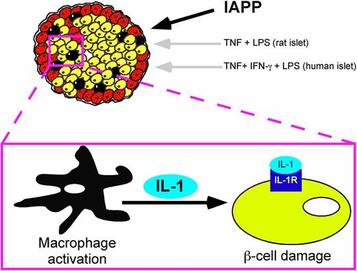 Figure 1. Intraislet macrophage activation and β-cell damage. Westwell-Roper et al. (14) provide evidence that IAPP damages β-cells (yellow) by a mechanism that is associated with resident islet macrophage (black) activation and the local release of IL-1β within islets to levels sufficient to damage β-cells. This pathway is consistent with previous studies showing that macrophage activators (TNF + LPS, rat; TNF + LPS + IFN-γ, mouse and human) cause β-cell damage through the local generation of IL-1 in islets (18−20). Overall, these studies begin to define general mechanisms by which tissue macrophage activation may contribute to the loss of β-cell function under conditions associated with type 1 and 2 diabetes.