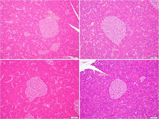 Figure 2. Liraglutide studies in nonhuman primates (hematoxylin and eosin staining). Endocrine pancreatic islets from males from 52 weeks’ study (left) and females from 87 weeks’ study (right) from control (upper row) or liraglutide high-dose group (lower row). Well-demarcated islets with normal-looking pale islet cells. Liraglutide-dosed animals look similar to what is seen in control animals. Original magnification ×200; bar indicates 100 µm.